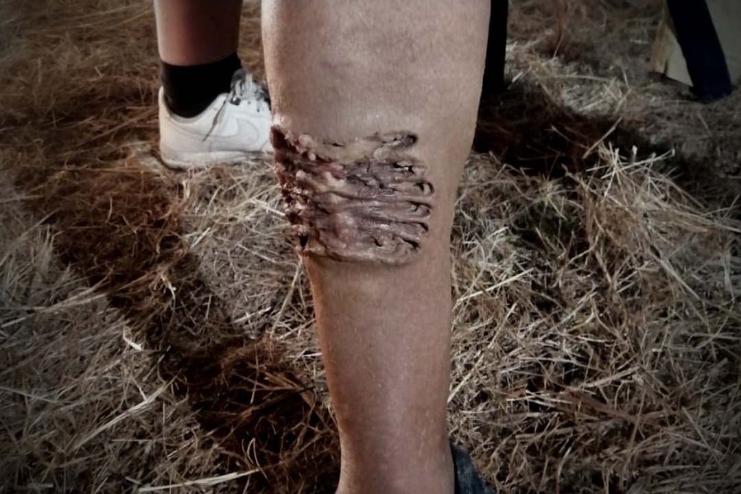 Prosthetics, Blood Rigs, Creatures · Prosthetic s