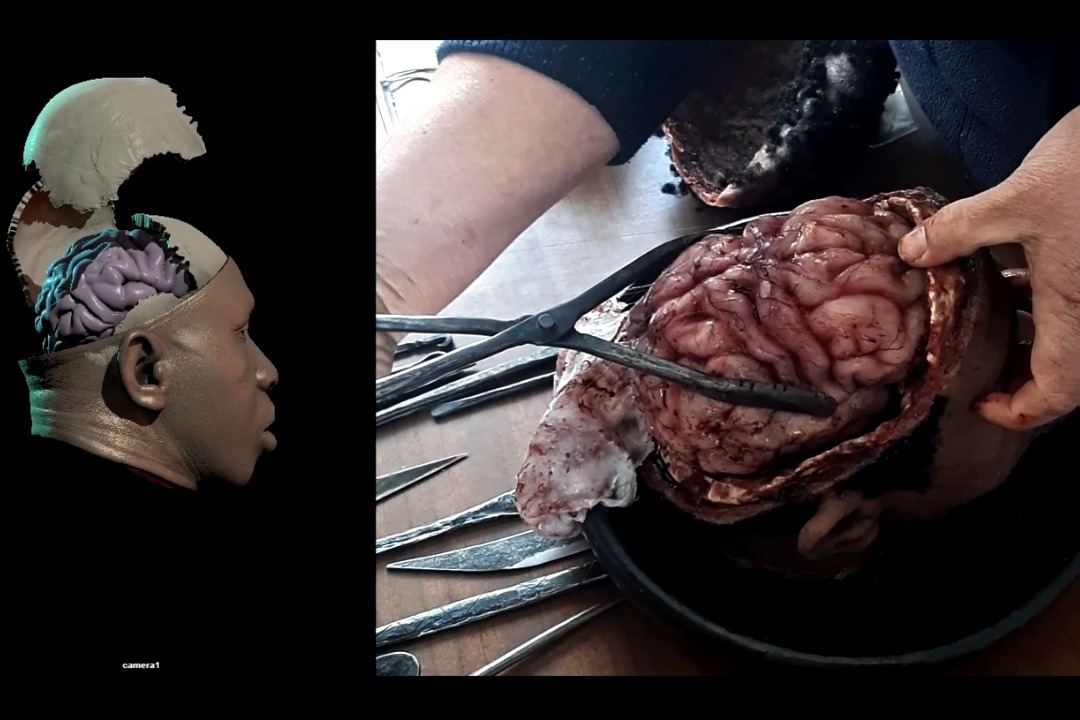 Prosthetics, Blood Rigs, Creatures · Prosthetic s