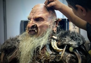 Prosthetic s